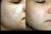 Aanya Skin Clinic  -