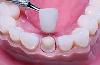 Dental Cure And Care Centre -