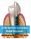 Dr Chopra Dental Clinic -